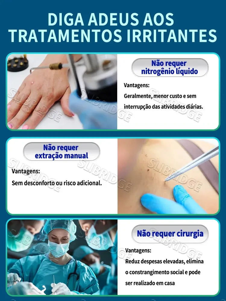 Caneta Não Invasiva Para Remoção De Verrugas