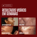 Sérum Clareador Envy Skin Ácido Tranexâmico