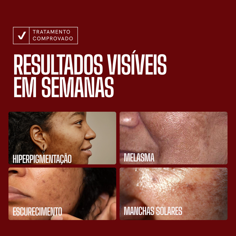 Sérum Clareador Envy Skin Ácido Tranexâmico