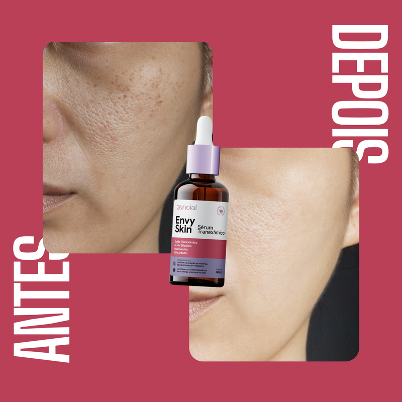 Sérum Clareador Envy Skin Ácido Tranexâmico